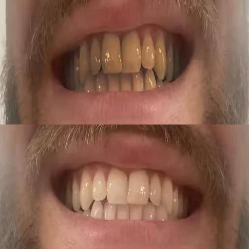 Resultado antes y después