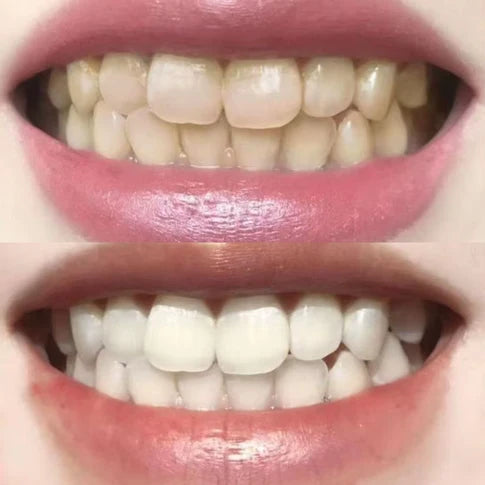 Resultado antes y después