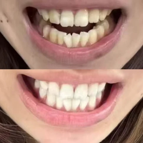 Resultado antes y después